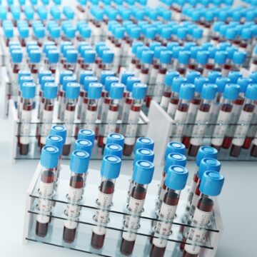 Coronavirus Disease 2019 Testing Basics Coronavirus Disease 2019 Testing Basics