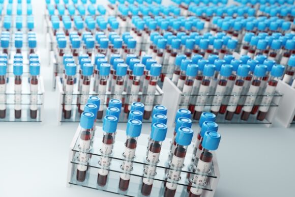 Coronavirus Disease 2019 Testing Basics