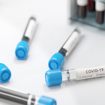 COVID-19: odporność zbiorowa, lockdowny i ograniczenia