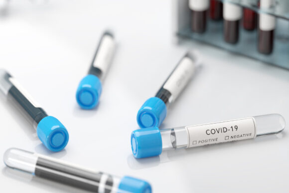 COVID-19: odporność zbiorowa, lockdowny i ograniczenia