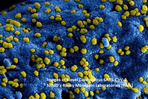 New Images of Novel Coronavirus SARS-CoV-2 Now Available
