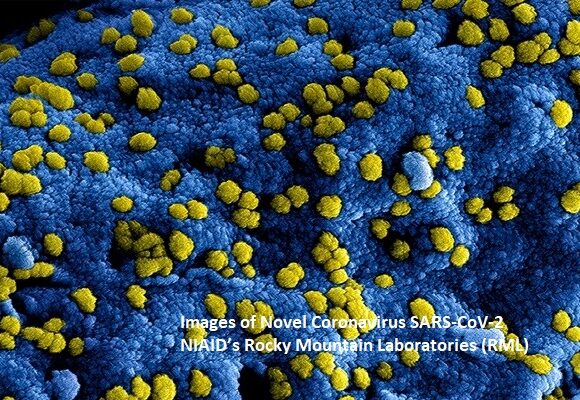New Images of Novel Coronavirus SARS-CoV-2 Now Available
