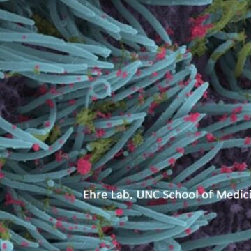 A Close-up of COVID-19 in Lung Cells