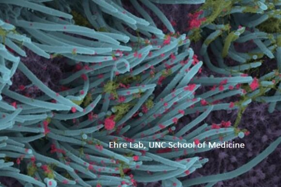 A Close-up of COVID-19 in Lung Cells