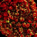 New Images of Novel Coronavirus SARS-CoV-2