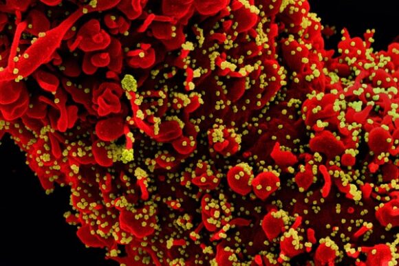 New Images of Novel Coronavirus SARS-CoV-2