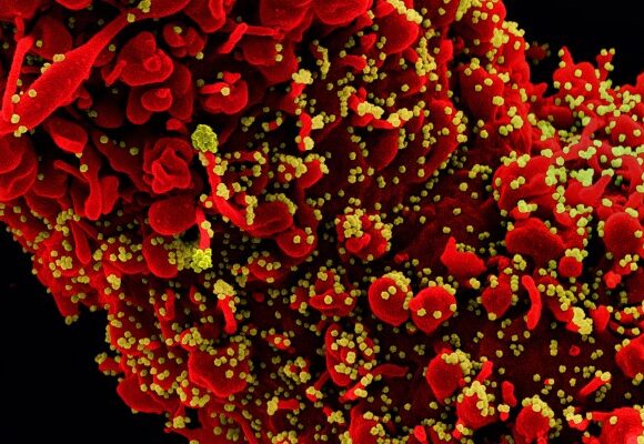 Kolejne zdjęcia mikroskopowe SARS-CoV-2