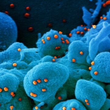 Nowe zdjęcia mikroskopowe SARS-CoV-2