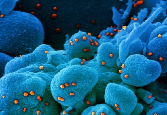 Nowe zdjęcia mikroskopowe SARS-CoV-2