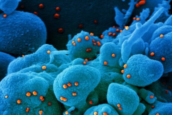 Next Images of Novel Coronavirus SARS-CoV-2