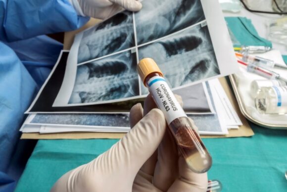 New Clues to Delta Variant’s Spread in Studies of Virus-Like Particles