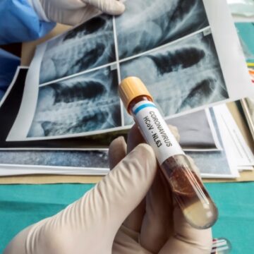 Nowe wskazówki dotyczące rozprzestrzeniania się Delta Variant w badaniach nad cząstkami wirusopodobnymi