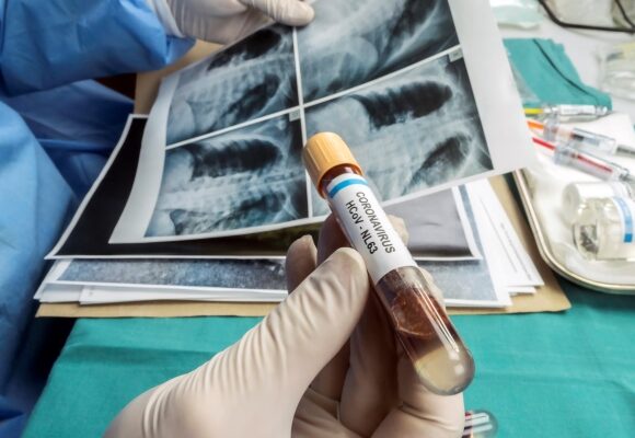 Nowe wskazówki dotyczące rozprzestrzeniania się Delta Variant w badaniach nad cząstkami wirusopodobnymi