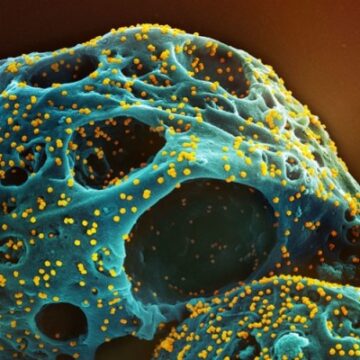 Nowe zdjęcia mikroskopowe SARS-CoV-2 (Omicron)