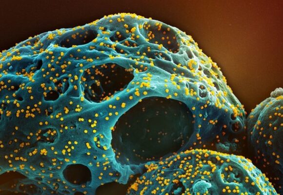 Nowe zdjęcia mikroskopowe SARS-CoV-2 (Omicron)